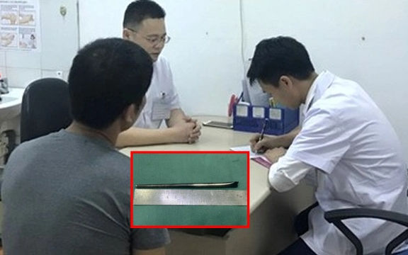 Hy hữu người đàn ông sống 8 năm với chiếc đũa kim loại mắc trong cổ họng và cái kết