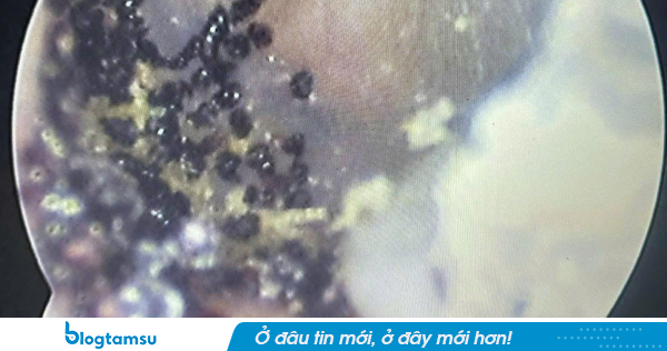 Hình ảnh từ tai bé 7t ở Khánh Hoà khiến nhiều cha mẹ sửng sốt: Không thể nuôi con thế này được!