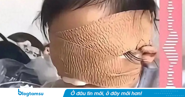 Bé gái mất thị lực hoàn toàn vì một thứ rất nhiều phụ huynh đang cho con chơi mỗi ngày