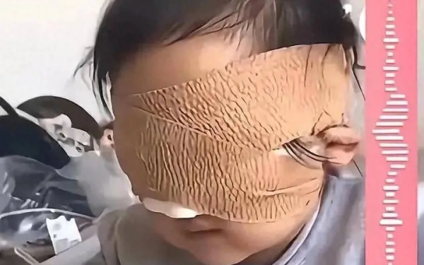 Bé gái mất thị lực hoàn toàn vì một thứ rất nhiều phụ huynh đang cho con chơi mỗi ngày