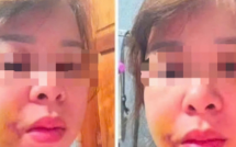 Đắk Lắk: Người mẹ 3 con cầu cứu sau nhiều lần bị chồng hành hung