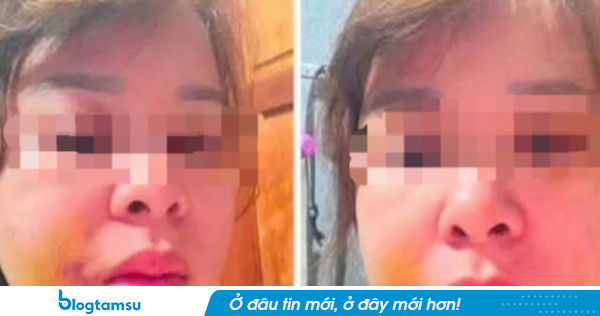 Đắk Lắk: Người mẹ 3 con cầu cứu sau nhiều lần bị chồng hành hung