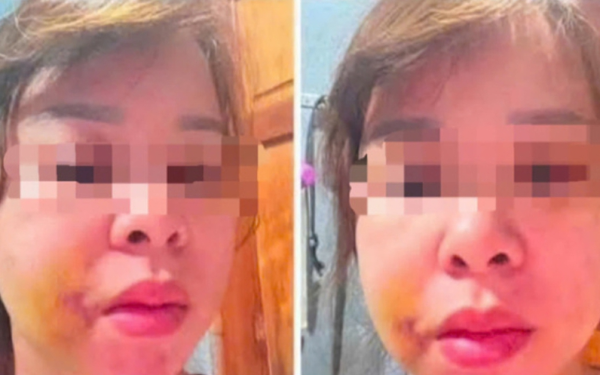 Đắk Lắk: Người mẹ 3 con cầu cứu sau nhiều lần bị chồng hành hung