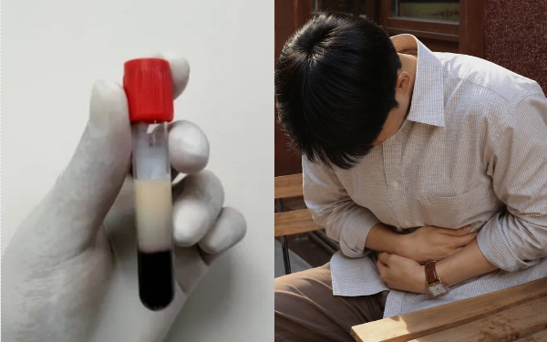 Người đàn ông 28 tuổi máu ngập mỡ, nhớt như dầu: Tất cả tại 2 món khoái khẩu và 2 loại nước "vạn người mê"
