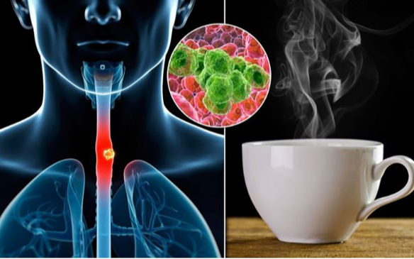 Loại nước "nuôi tế bào UT", uống mỗi ngày có thể tăng gấp 6 lần nguy cơ: Nhiều người Việt hay dùng