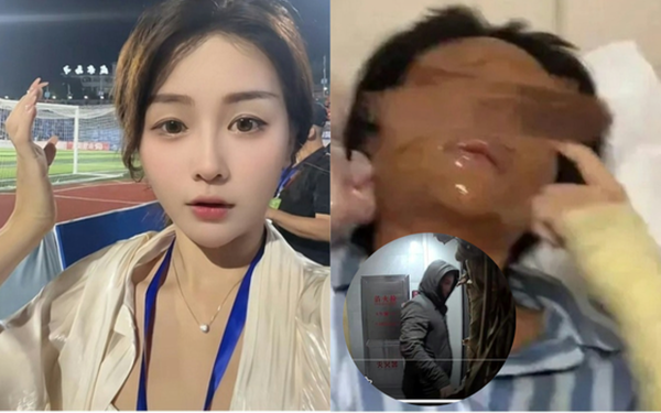 Nữ streamer xinh đẹp bị “hủy dung” sau khi mở gói hàng, danh tính shipper được tiết lộ khiến cô hoảng sợ