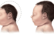 Nhiều món ăn chứa các "sát thủ" gây UT, teo não ở trẻ nhỏ mà bố mẹ vẫn cho con ăn hàng ngày mà không lường trước hậu quả