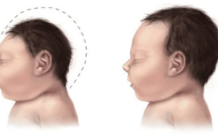 Nhiều món ăn chứa các "sát thủ" gây UT, teo não ở trẻ nhỏ mà bố mẹ vẫn cho con ăn hàng ngày mà không lường trước hậu quả