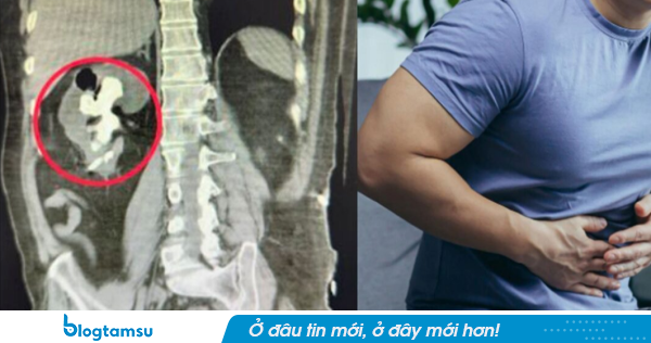 Người đàn ông 51 tuổi 