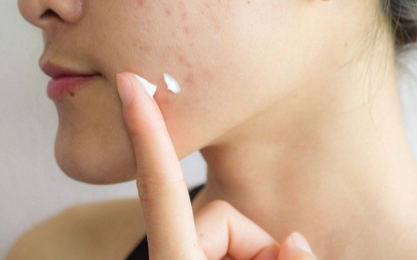 Thu hồi toàn quốc 5 mỹ phẩm của Kencare Việt Nam