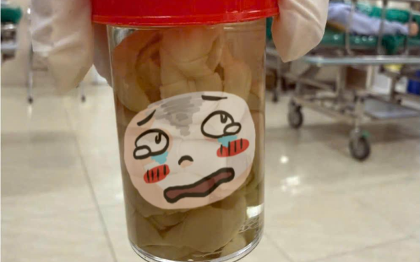 Nhìn qua tưởng hũ dưa chua nhưng đây là sản phẩm lấy ra từ bụng của một người đàn ông Hà Nội