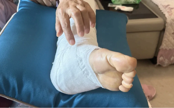 Bỏ qua nốt ruồi ở vị trí ít ai ngờ, người phụ nữ bàng hoàng khi ung thư đã di căn
