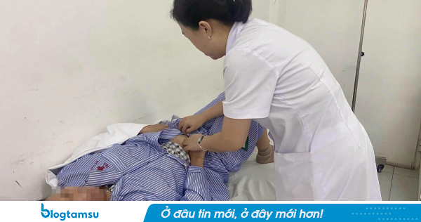6 tháng rụng tóc, nổi ban đỏ, cô gái 22 tuổi SUY SỤP khi bác sĩ chẩn đoán