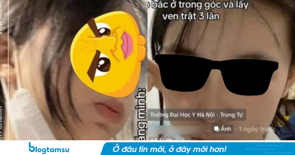 Thêm một sinh viên trường Y lên Tiktok viết conten 
