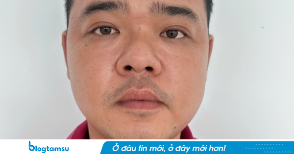Truy nã đặc biệt Huỳnh Minh Trung SN 1995, bất kỳ người nào cũng có quyền bắt và giải ngay đến Công an