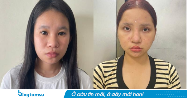 Bắt khẩn cấp 