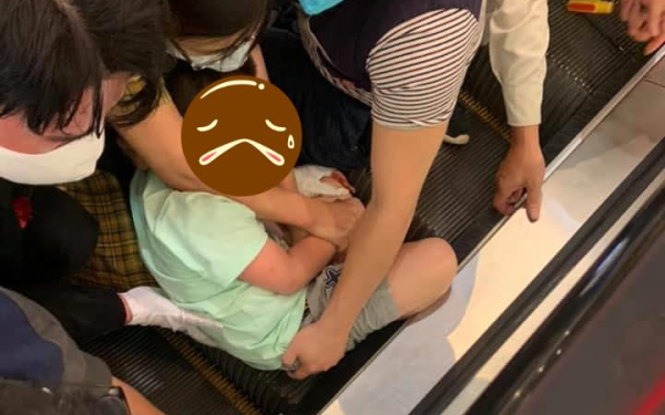Đừng cho trẻ đi loại dép này: Đã có bé bị gãy xương, thậm chí dậy thì sớm và không phát triển được chiều cao