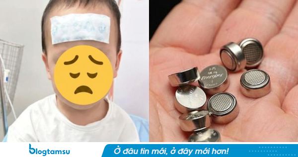 Cháu trai nuốt phải pin cúc áo, bà nội đòi dùng mẹo dân gian để chữa, bác sĩ cảnh báo tuyệt đối không làm theo