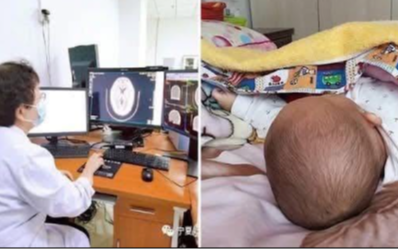Trẻ ngủ gối và trẻ không kê gối có thể khác nhau thế nào khi lớn lên? Không chỉ IQ, cột sống cũng có khác biệt