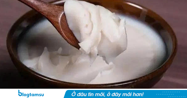 Ăn mỡ lợn mỗi ngày, người phụ nữ 56 tuổi bất ngờ khi đi khám, bác sĩ hôt hoảng: 