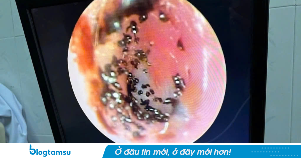 Hình ảnh từ tai bé 9t ở Cần Thơ khiến nhiều cha mẹ rùng mình: Sao lại nuôi con thế này?
