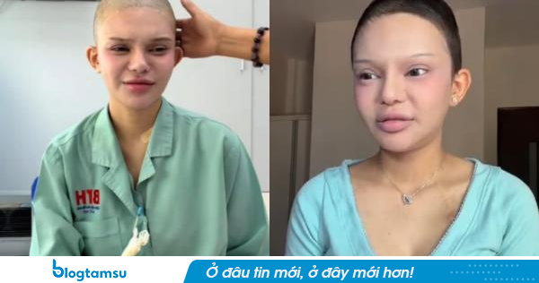 Đan Thy sau 2 tháng điều trị UT máu nhưng không thuyên giảm đã xin về nhà
