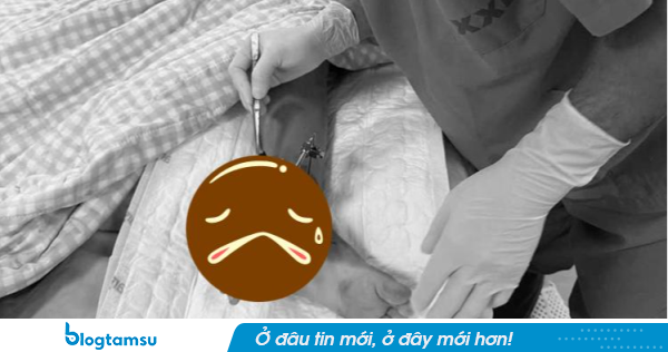 Bé trai bị cổng sập đè đứt chi được bác sĩ ghép tạm bàn tay vào chân