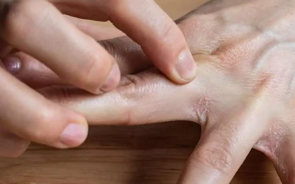 '2 ngứa, 2 hôi' cảnh báo ung thư gan đang lớn nhanh như thổi