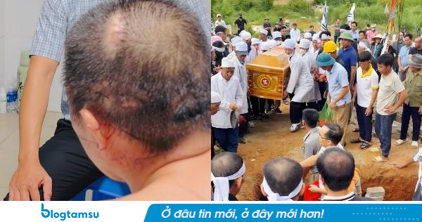 Thương hơn chữ thương: Tròn 1 tháng vợ con đã an táng vẫn chưa thể ra mộ thắp nén hương, anh Nguyễn Viết Quang nhận thêm tin đau lòng liên quan đến 3 mẹ con