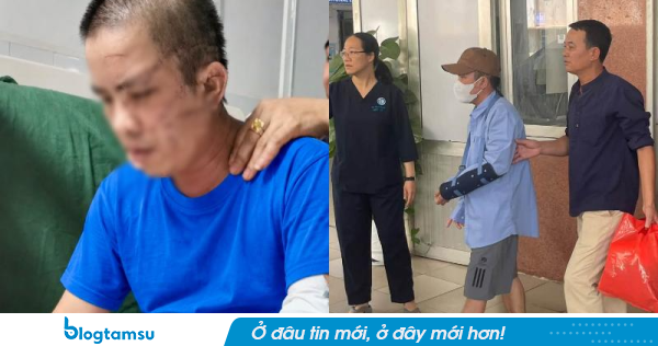 Xót xa cảnh xuất viện của anh Quang nạn nhân thảm án Đồng Nai: Hé lộ hành trình tiếp theo!