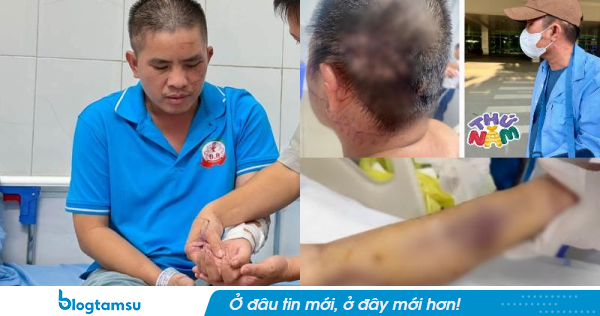Tình trạng hiện tại của anh Quang, toàn bộ vết thương trên người xót xa vô cùng
