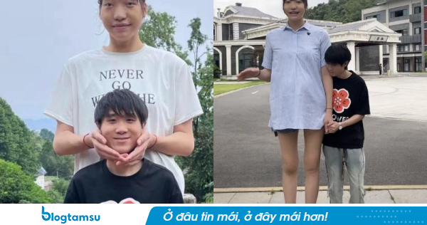 Cô gái 2m2 qua đời ở tuổi 26: Chồng 1m68 tiết lộ nguyên nhân